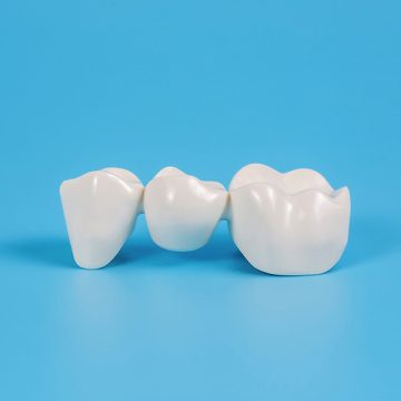 How You Can Restore Your Damaged Teeth with Dental Crowns