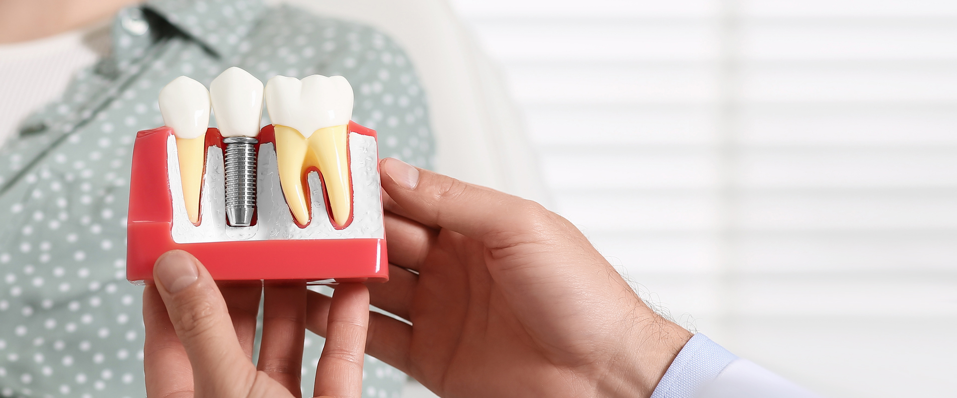 Free Implant Consultation 