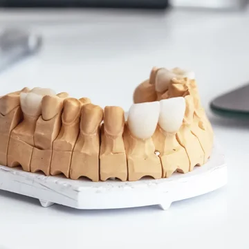 Dental Veneers in Salem, MA: What to Expect at Your Consultation